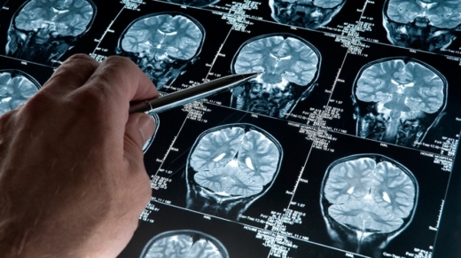 Software Alzheimer