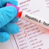 Hepatitis A