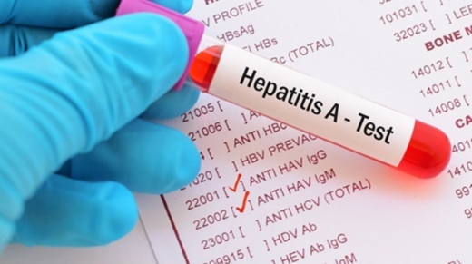 Hepatitis A