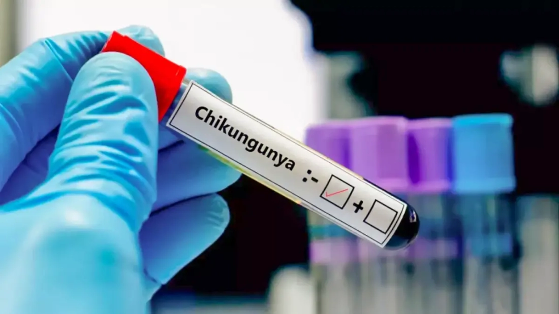 Chikungunya